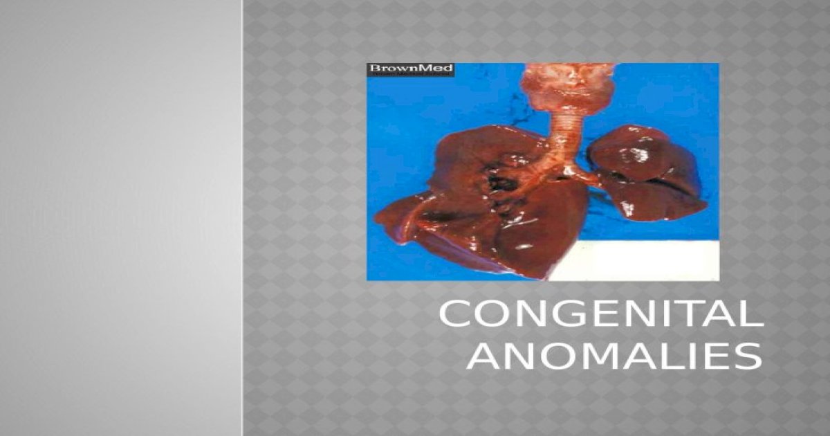 congenital anomaly